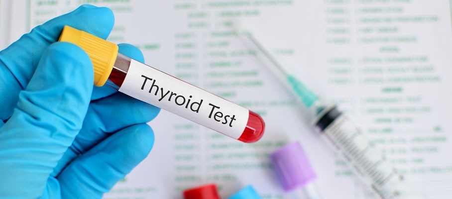 Thyroid test &#8211; what does it look like, how much does it cost, or should it be done on an empty stomach?