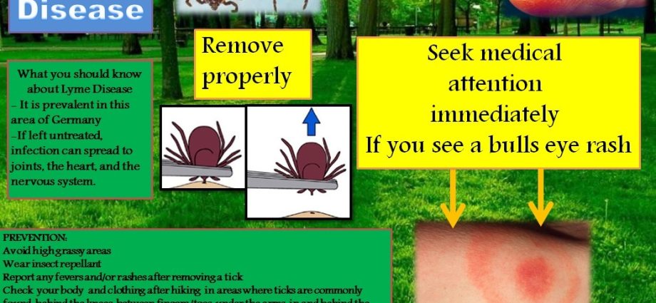 Ticks &#8211; what diseases do they transmit? Tick ​​removal