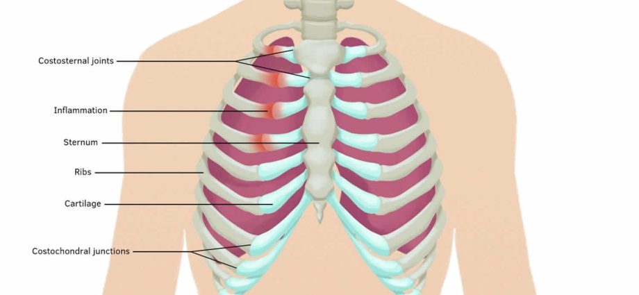 Tietz syndrome &#8211; what is it? Diagnostics and treatment