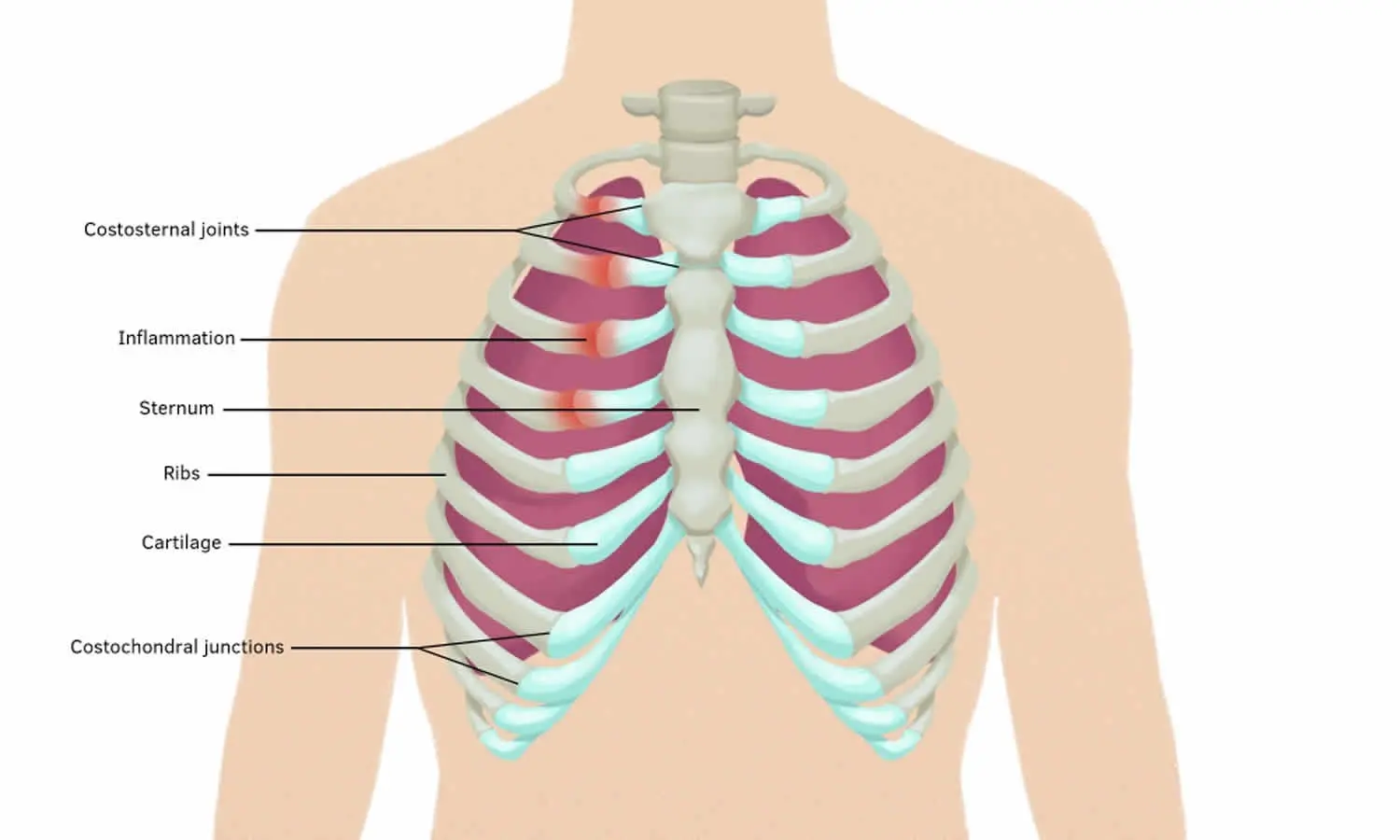 Tietz syndrome &#8211; what is it? Diagnostics and treatment