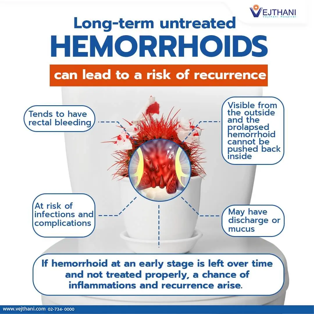 Time for Health: Hemorrhoids