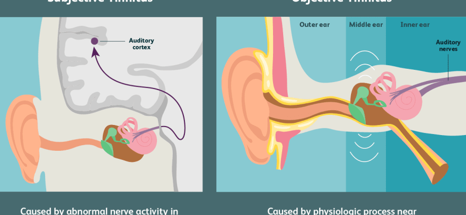 Tinnitus? We know the causes