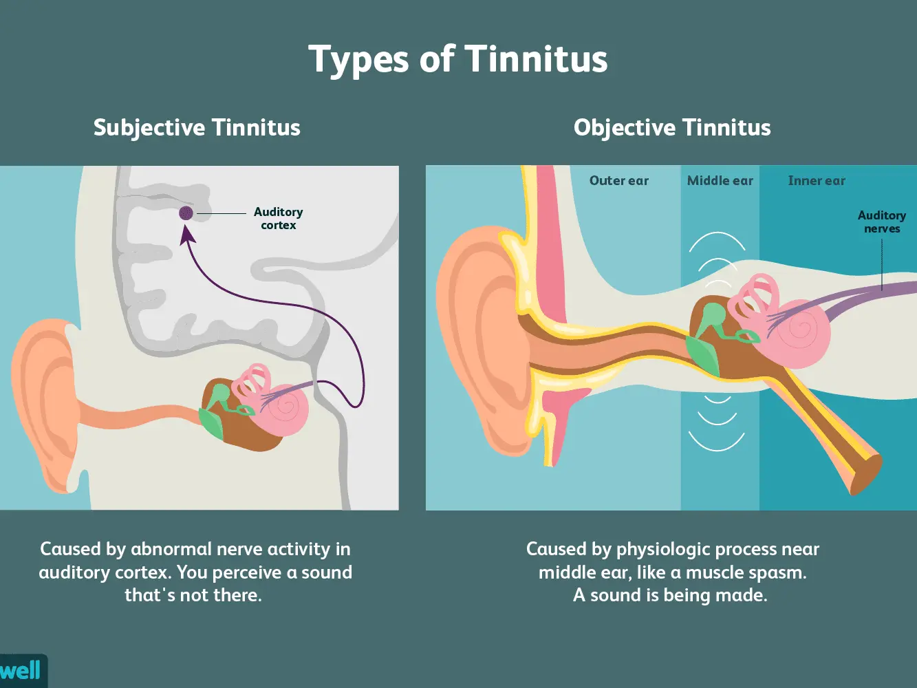 Tinnitus? We know the causes