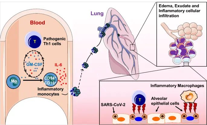 Tocilizumab &#8211; a drug for COVID-19. How does it work, who can apply?