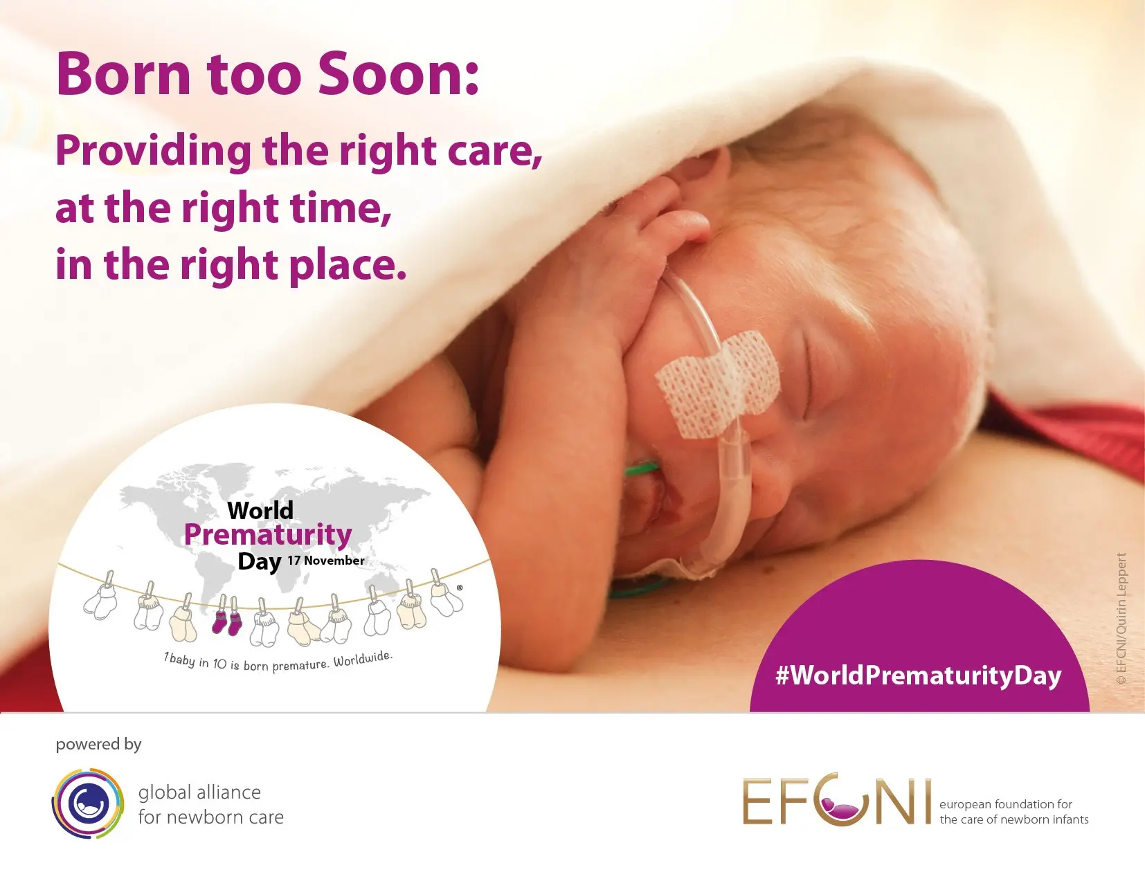 Together for premature babies &#8211; for the sake of their future