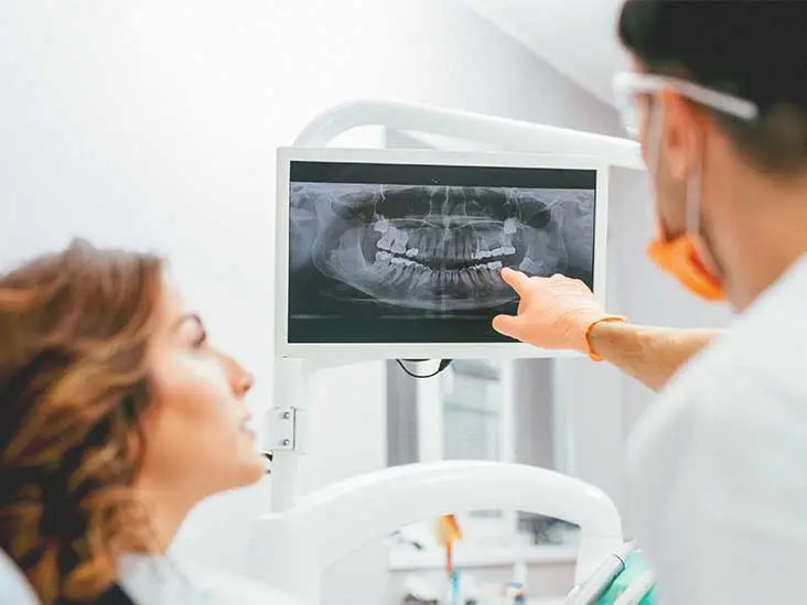 Tooth X-ray &#8211; when to perform, what can be used to diagnose it, how is it going