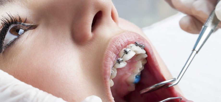 Toothless like a Pole &#8211; caries in children, braces, visit to the dentist