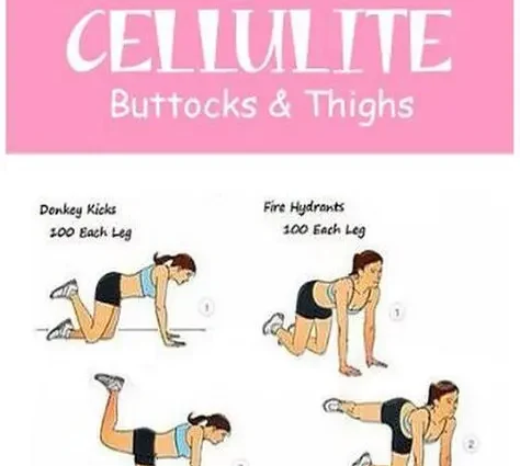 TOP 4 most effective exercises for cellulite on the thighs and buttocks