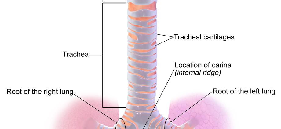 Tracheitis &#8211; symptoms and treatment. Is tracheitis dangerous?