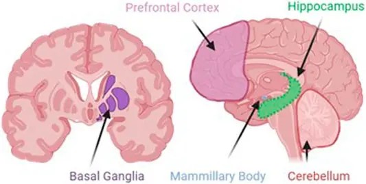 Tran helps protect the brain of alcoholics from dementia