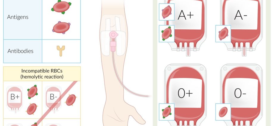 Transfusion &#8211; what is it? When is it performed and is it safe?