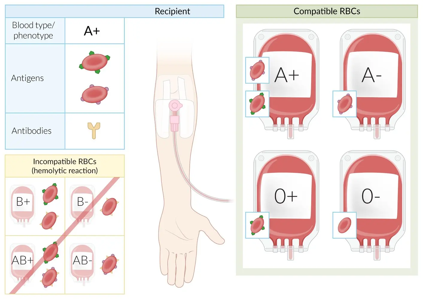 Transfusion &#8211; what is it? When is it performed and is it safe?