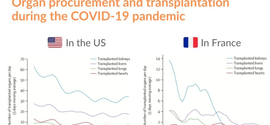 Transplantation in the era of coronavirus. The number of transplants is declining