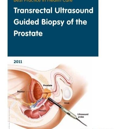 Transrectal ultrasound &#8211; indications, preparation, course