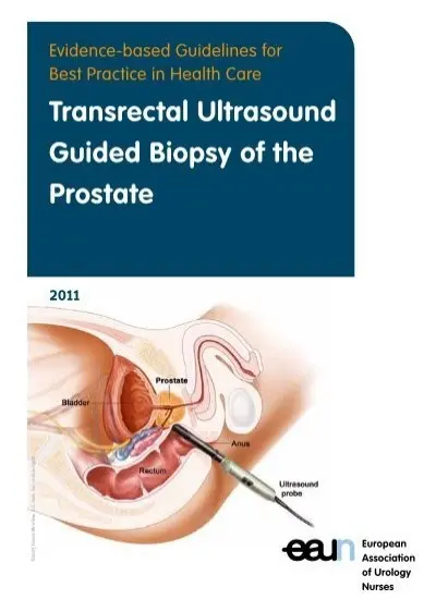 Transrectal ultrasound &#8211; indications, preparation, course