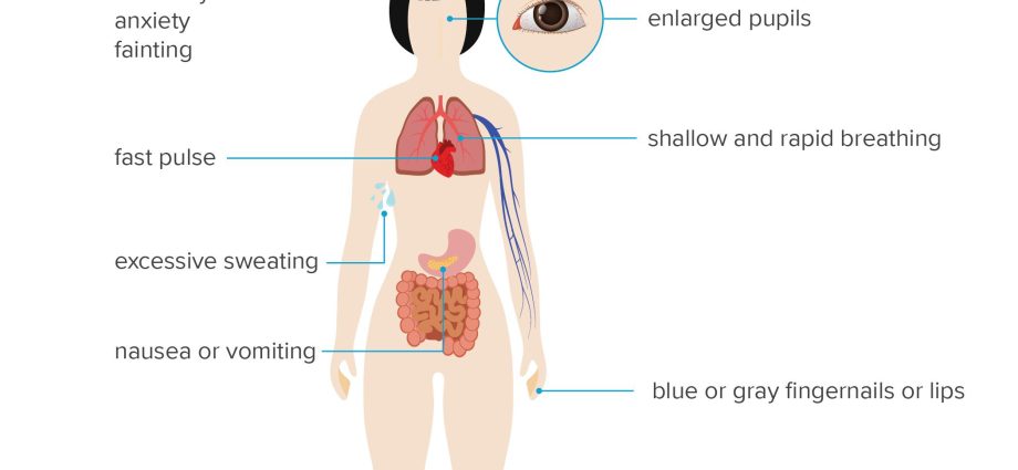 Traumatic shock &#8211; symptoms and procedures