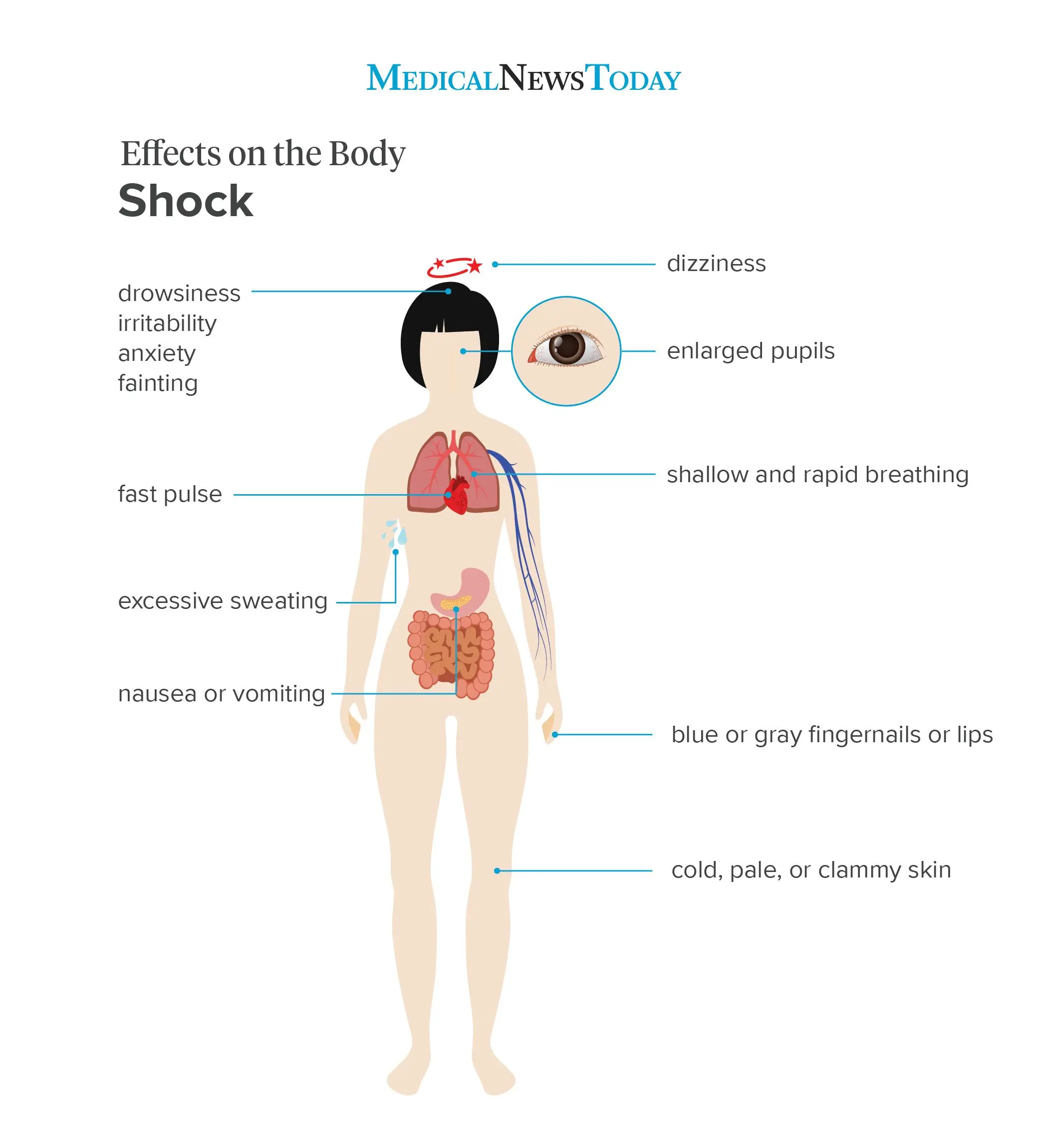 Traumatic shock &#8211; symptoms and procedures