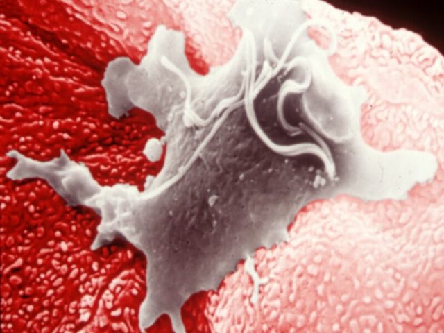 Treatment and testing for bovine trichomoniasis