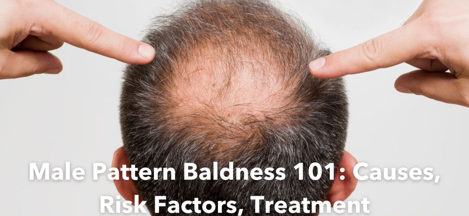 Treatment of baldness can cause a permanent decrease in libido