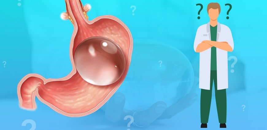 Treatment of obesity with a gastric balloon &#8211; what is it? The price of the procedure