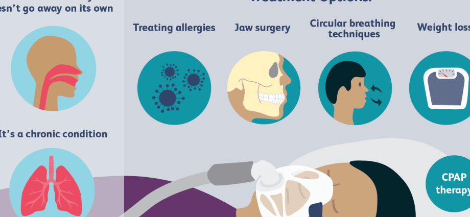 Treatment of snoring and sleep apnea. How much does it cost and where to do?