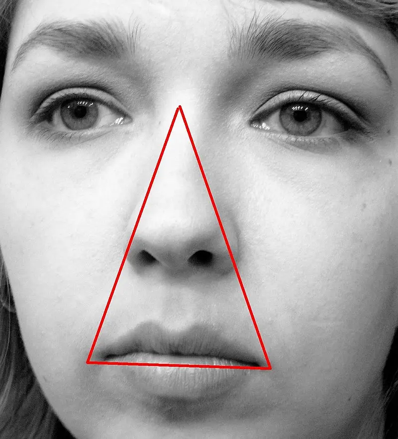 &#8220;Triangle of death&#8221; on the face