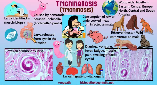 Trichinellosis &#8211; symptoms, treatment and causes of the disease