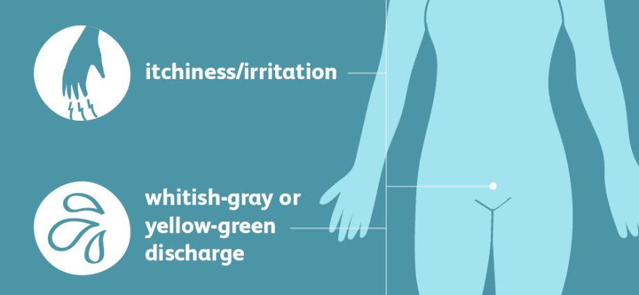 Trichomoniasis vaginitis &#8211; symptoms and diagnosis