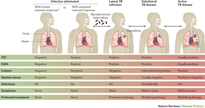 Tuberculosis &#8211; the disease is still relevant