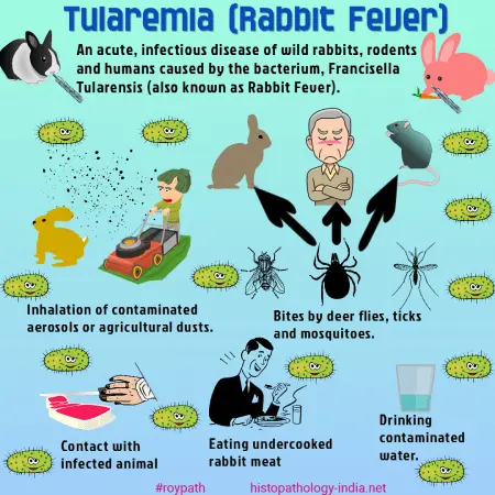 Tularemia &#8211; causes, symptoms and treatment