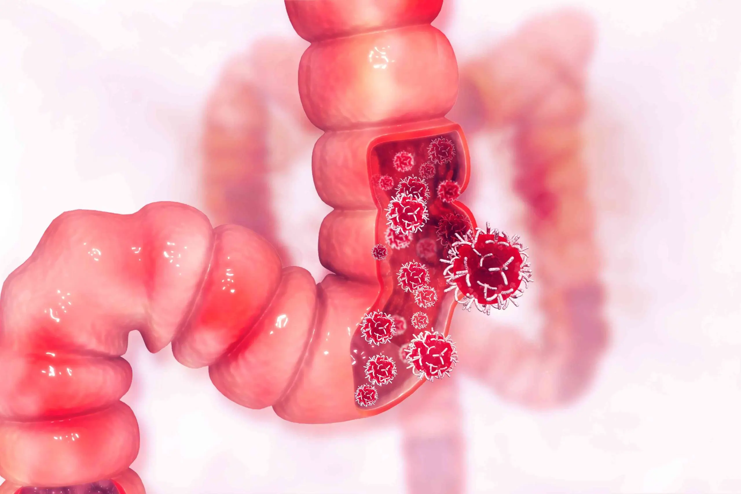 Tumors that kill fastest
