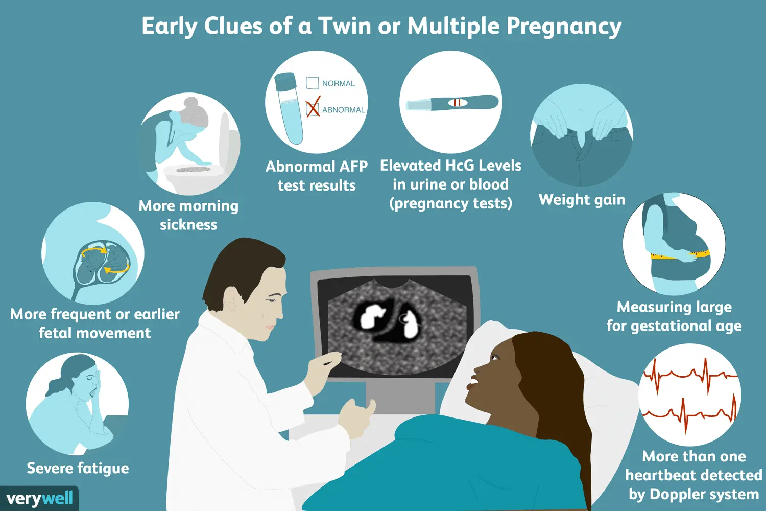 Twin pregnancy &#8211; how to recognize? Symptoms of twin pregnancy