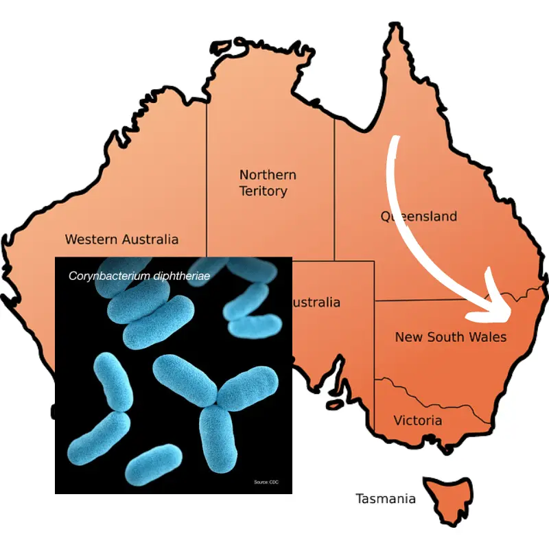 Two cases of diphtheria in Australia. The contagious disease returned after many years