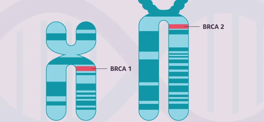 Two new genes related to breast cancer were discovered. They increase the risk of disease up to two times