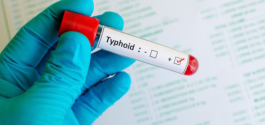 Typhus, or typhoid fever. How can you prevent typhoid fever?