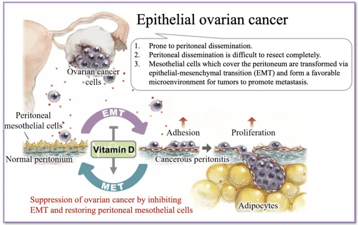 Unexpected effect of taking vitamin D. It is ovarian cancer