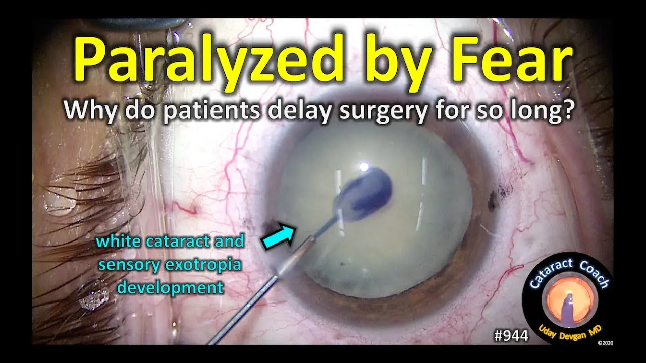 Untreated cataracts lead to blindness. Poles are afraid of surgery?