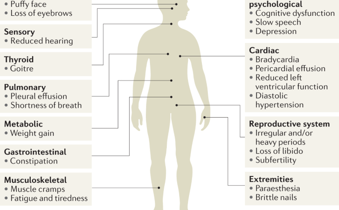 Untreated hypothyroidism in even half of patients