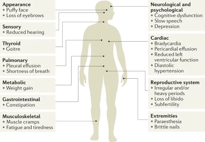 Untreated hypothyroidism in even half of patients