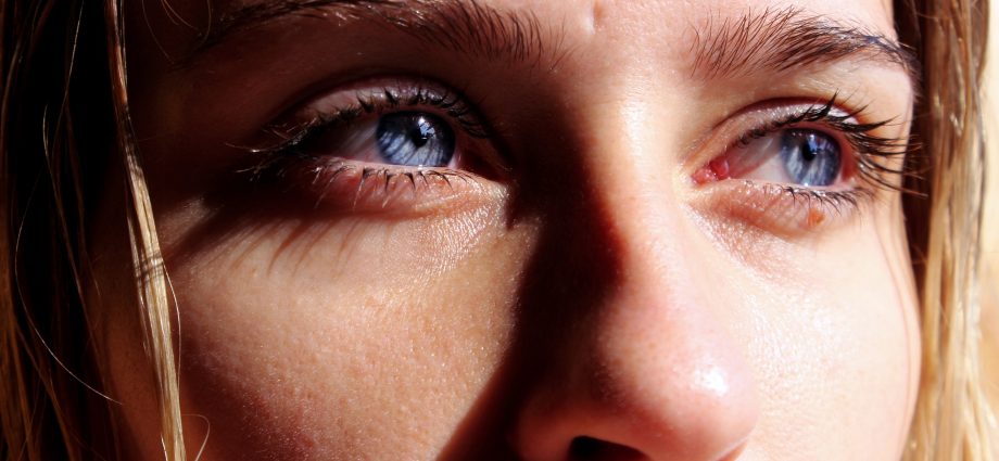 Unusual signs that you have an Omicron infection. Strange things happen to the eyes