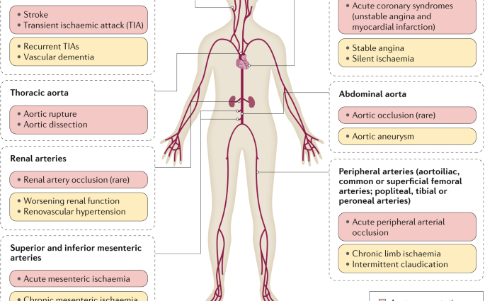 Unusual symptoms of atherosclerosis. They appear many years ahead of the rest