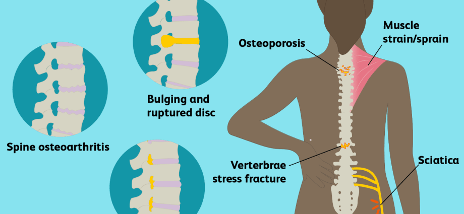 Unusual symptoms of back problems