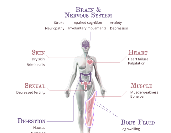 Uremia &#8211; causes, symptoms, treatment