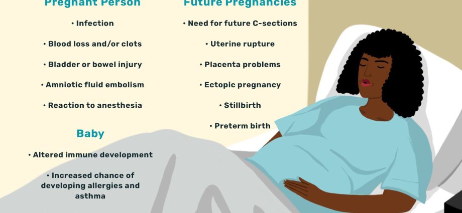 Urgent caesarean section &#8211; the risk is greater than the benefits