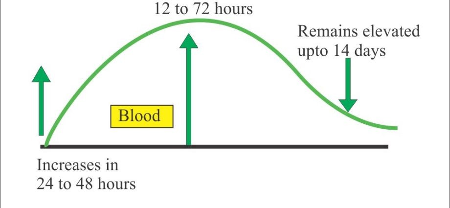 Urine amylase &#8211; when to test, test