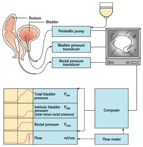 Urodynamic examination &#8211; what do they look like? Indications and preparation