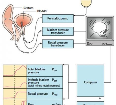 Urodynamic testing &#8211; what is it? How long are they? Indications for urodynamic tests