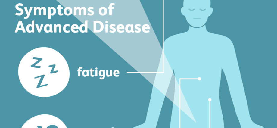 Urological neoplasms. Two serious symptoms that must not be ignored &#8211; may be a sign of cancer