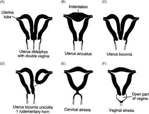 Vaginal cleanliness test &#8211; what is it? What is the importance of the vaginal flora?