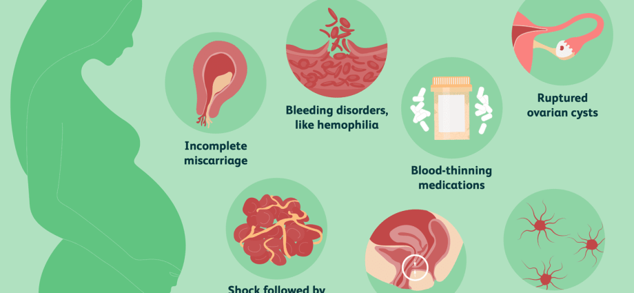 Vaginal haemorrhage &#8211; causes and procedures